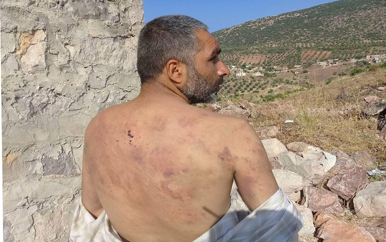 عفرين .. مسلحو فيلق الشام يقومون بضرب مواطن مختل عقليا في قرية كوسا 