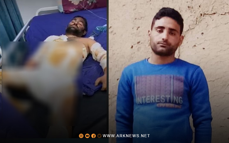 وفاة شاب من قامشلو متأثراً بحروق جراء انفجار بابور الكاز