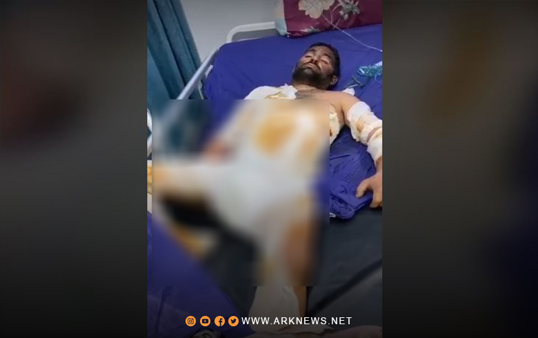 Qamishlo... The explosion of a Kerosene Papour causes the body of a young Kurdish man to burn by 75%