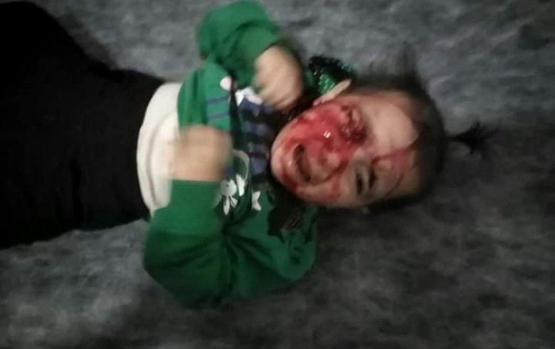 Li Efrînê bombeyek teqiya , û ziyan hene