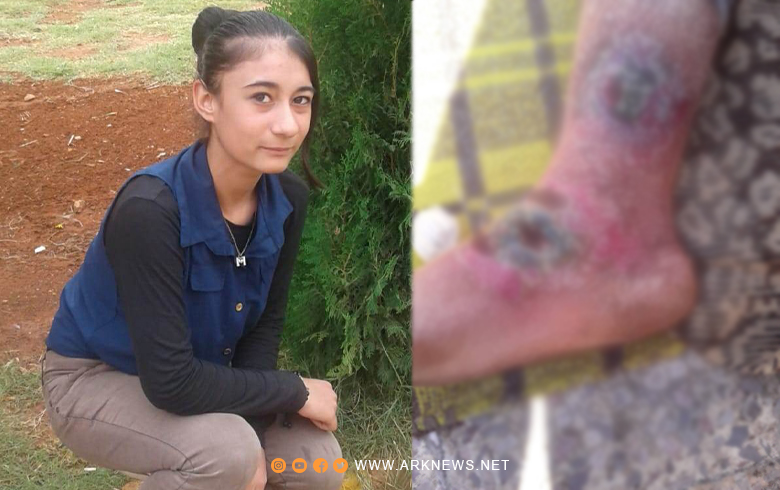 A source for ARK: The SDF returns a minor to her parents, but after she suffers from a chronic illness