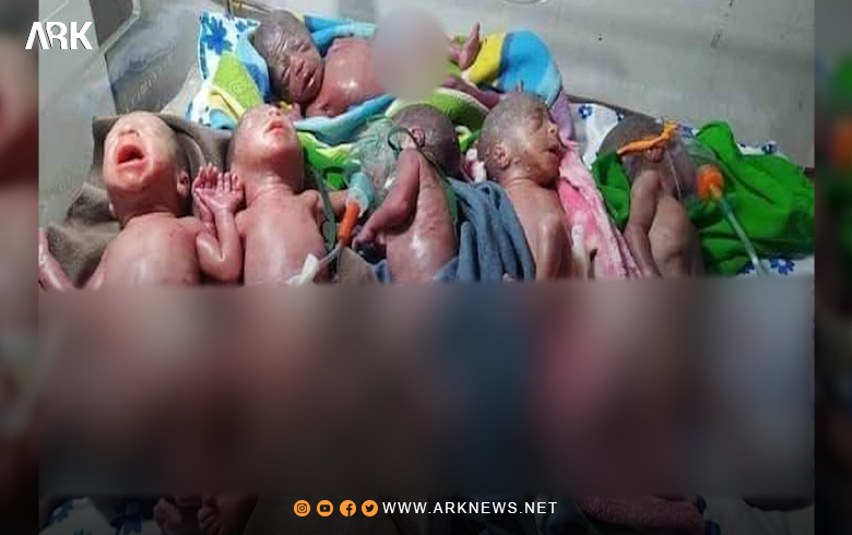 في حالة نادرة.. امرأة تنجب توأم سداسي في مدينة منبج 