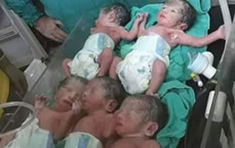  قامشلو .. عائلة التوائم الخمسة تناشد بتقديم يد العون لهم 