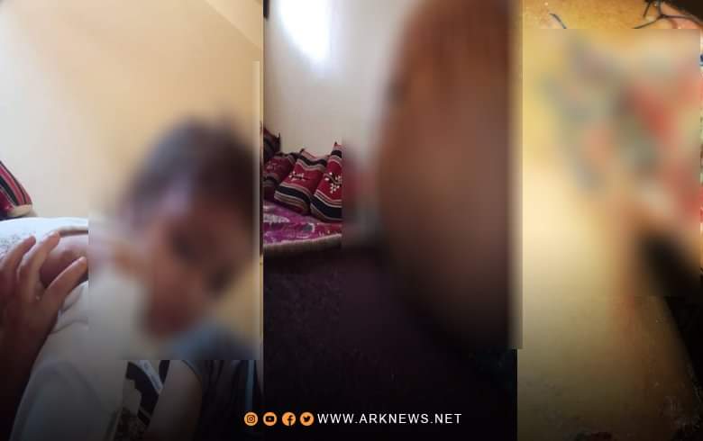 إصابة أفراد عائلة كوردية بانفجار لغم في كوباني 