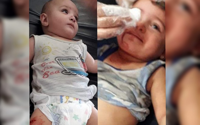 In pictures .. The victims of the bombing on Afrin, most of them children In pictures .. The victims of the bombing on Afrin, most of them children