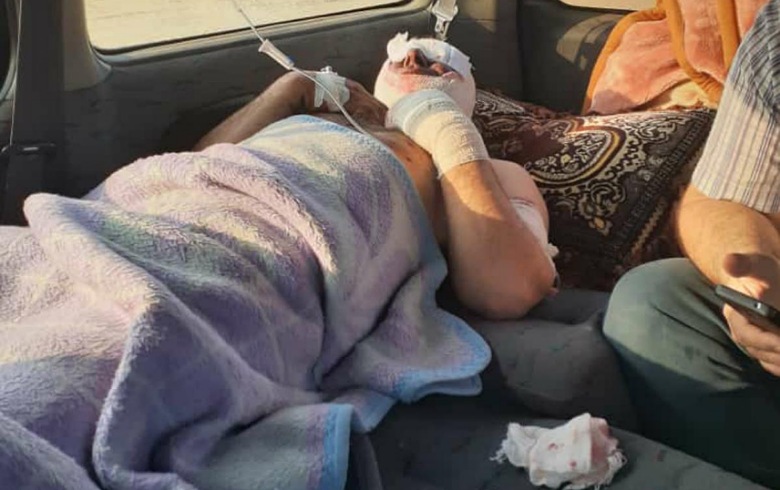 انفجار لغم يتسبب في إصابة مدني من كوباني