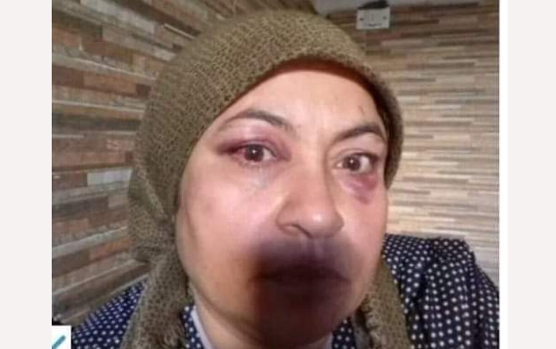 عفرين... الاعتداء على امرأة كوردية بعد مطالبتها لإخلاء منزلها 