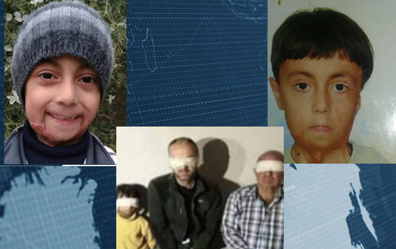 ARK  reveals the fate of the child Mohammed in Afrin
