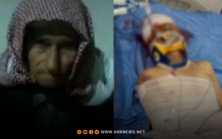Afrin… Announcing the death of a Kurdish elderly in a terrorist bombing in the Afrin region