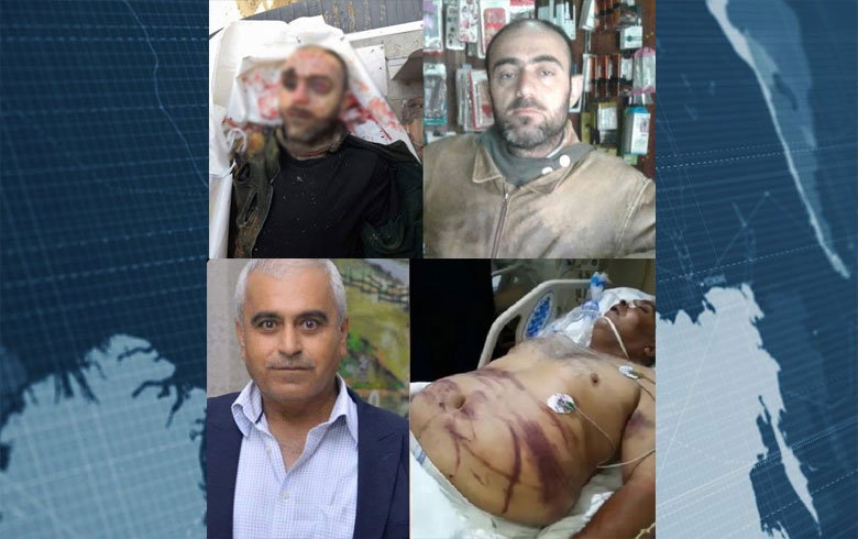 عفرين ..استشهاد مدنيين كورديين تحت التعذيب (صور )