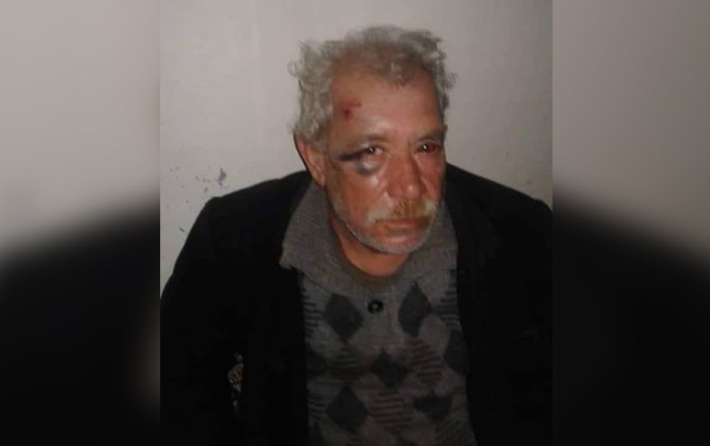 عفرين .. الاعتداء على رجل مسن في ترندى 