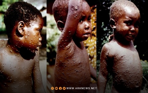 تسجيل أول حالة وفاة ناجمة عن فيروس 