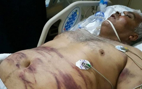 عه‌فرين .. وه‌لاتييه‌كي كورد راستي ئه‌شكه‌نجه‌ێ تێ 