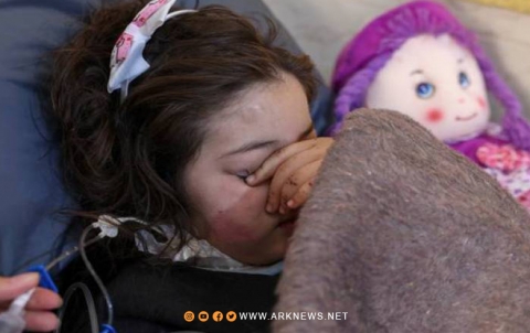 بعد نجاتها من الزلزال.. الطفلة السورية شام تفقد ساقيها بعد نجاتها من الزلزال.. الطفلة السورية شام تفقد ساقيها