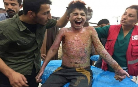 Investigations on the use of chemical weapons by Turkey in Syrian Kurdistan Investigations on the use of chemical weapons by Turkey in Syrian Kurdistan