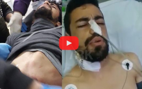 عفرين... الكوردي الإيزيدي دلو محمد ينفي بالفيديو خبر استشهاده عفرين... الكوردي الإيزيدي دلو محمد ينفي بالفيديو خبر استشهاده