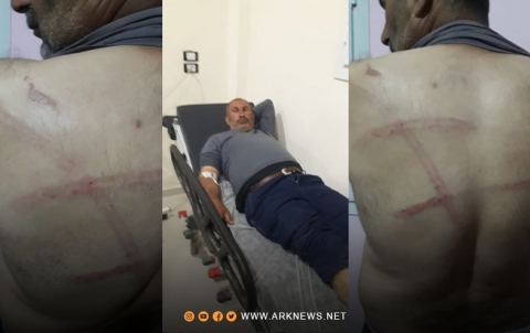 عفرين... مسلحو فيلق الشام يعتدون بشكل وحشي على مدني كوردي