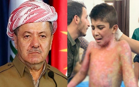 الرئيس بارزاني يشكر فرنسا على تقديم العلاج للطفل محمد وإنقاذه من الموت 