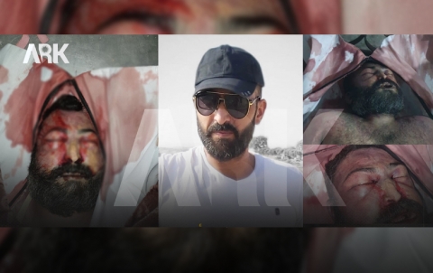 قانوني سوري يعلق على الصور التي نشرتها إدارة PYD للشاب أمين عيسى قانوني سوري يعلق على الصور التي نشرتها إدارة PYD للشاب أمين عيسى