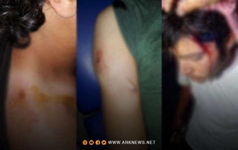 إصابات بين صفوف المدنيين في عفرين 