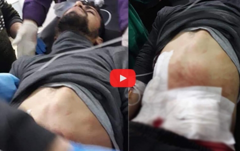 عفرين... فيديو إطلاق النار على مدني بسبب رفضه الخروج من منزله عفرين... فيديو إطلاق النار على مدني بسبب رفضه الخروج من منزله
