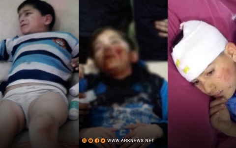 عفرين... ضحايا مدنيّون إثر القصف المتبادل وناشط يؤكد: 