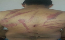 عفرين..  مسلحو الشرقية يعذبون مدنيا و يطلبون فدية مقابل الإفراج عنه 