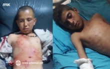 إصابة طفلين من مهجّري عفرين بانفجار في الشهباء