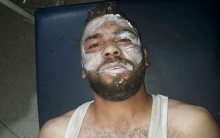 قامشلو ..إصابة أربعة أشخاص نتيجة انفجار اسطوانة غاز