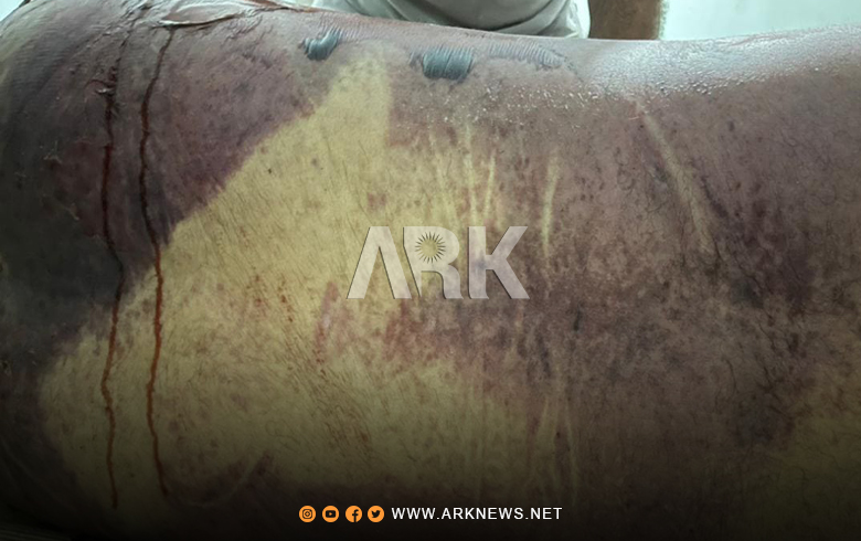 Exclusive Photos by ARK Shows the brutality to which young Amin was subjected