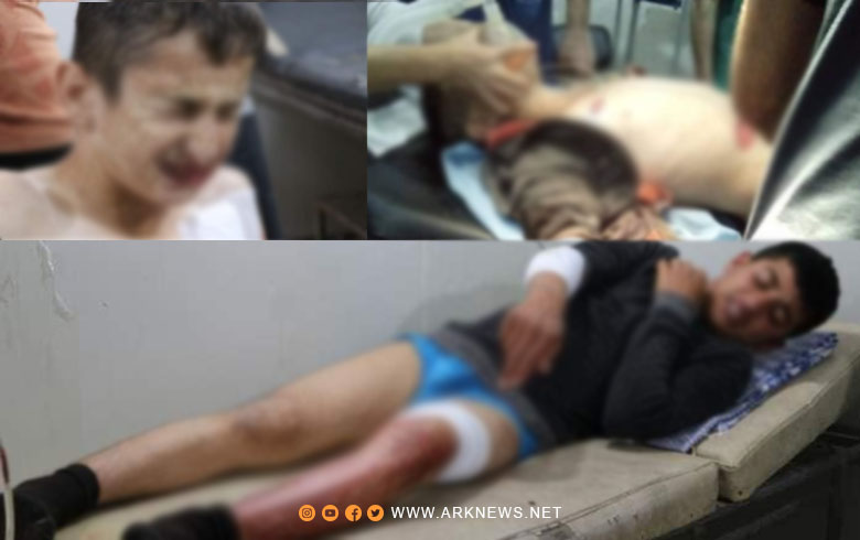 أربعة أطفال من مهجّري عفرين ضحايا ألغام PYD في الشهباء